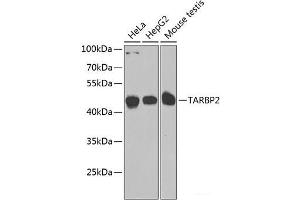 Western blot analysis of extracts of various cell lines using TARBP2 Polyclonal Antibody at dilution of 1:1000. (TARBP2 antibody)