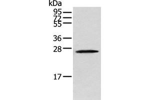 Western blot analysis of Human fetal brain tissue using TPPP Polyclonal Antibody at dilution of 1:250 (Tppp antibody)