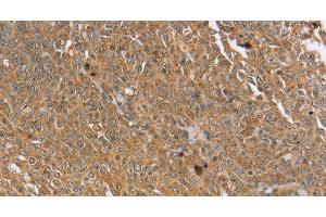 Immunohistochemistry (Paraffin-embedded Sections) (IHC (p)) image for anti-Protein Tyrosine Phosphatase, Non-Receptor Type 20B (PTPN20B) antibody (ABIN7243790)