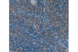 Figure. (COMP antibody  (AA 35-179))