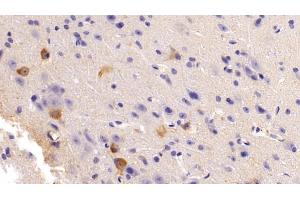 Detection of NOS1 in Mouse Cerebrum Tissue using Polyclonal Antibody to Nitric Oxide Synthase 1, Neuronal (NOS1) (NOS1 antibody  (AA 53-247))
