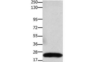 Western Blot analysis of Human colon cancer tissue using Claudin 3 Polyclonal Antibody at dilution of 1:550 (Claudin 3 antibody)