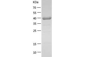 Western Blotting (WB) image for Tumor Necrosis Factor, alpha-Induced Protein 3 (TNFAIP3) (AA 2-357) protein (His tag) (ABIN7285635) (TNFAIP3 Protein (AA 2-357) (His tag))