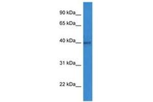 Image no. 1 for anti-ADP-Ribosyltransferase 1 (ART1) (C-Term) antibody (ABIN6746775) (ART1 antibody  (C-Term))