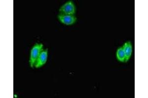 Immunofluorescent analysis of HepG2 cells using ABIN7169234 at dilution of 1:100 and Alexa Fluor 488-congugated AffiniPure Goat Anti-Rabbit IgG(H+L) (WNK4 antibody  (AA 828-1106))