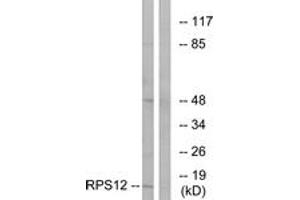 Western blot analysis of extracts from COLO cells, using RPS12 Antibody. (RPS12 antibody  (AA 83-132))