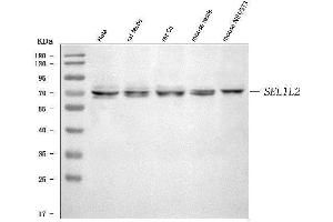 anti-Sel-1 Suppressor of Lin-12-Like 2 (SEL1L2) (AA 127-668) antibody