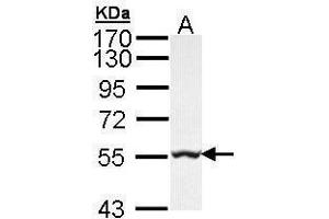 WB Image Sample (30 ug of whole cell lysate) A: Hep G2 , 7. (GLYCTK antibody)