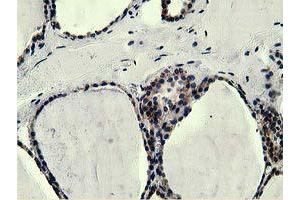 Immunohistochemical staining of paraffin-embedded Human liver tissue using anti-L1CAM mouse monoclonal antibody. (L1CAM antibody)