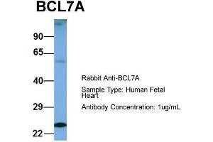 Host: Rabbit  Target Name: BCL7A  Sample Tissue: Human Fetal Heart  Antibody Dilution: 1. (BCL7A antibody  (Middle Region))