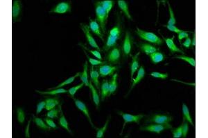 Immunofluorescence staining of Hela cells with ABIN7170983 at 1:250, counter-stained with DAPI. (SOD2 antibody  (AA 64-175))
