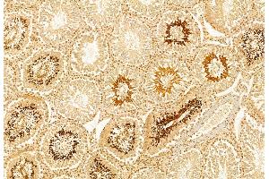 ABIN6262477 and ABIN6272870 at 1/100 staining Rat testis tissue by IHC-P.