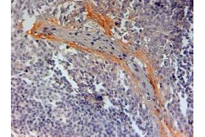 ABIN185676 (2µg/ml) staining of paraffin embedded Human Tonsil. (NLRP3 antibody  (Internal Region))