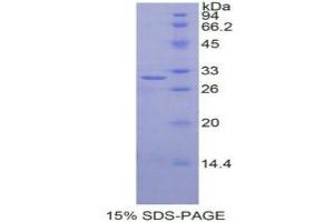 SDS-PAGE analysis of Human IGF2BP2 Protein.