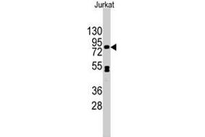 Western blot analysis of CDH12 polyclonal antibody  in Jurkat cell line lysates (35 ug/lane). (Cadherin 12 antibody  (N-Term))