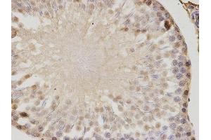 Immunohistochemistry (IHC) image for anti-Proteasome (Prosome, Macropain) Activator Subunit 1 (PA28 Alpha) (PSME1) antibody (ABIN1876546) (PSME1 antibody)