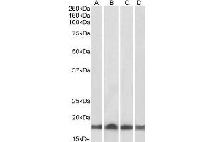 Western Blotting (WB) image for anti-Ubiquitin-Conjugating Enzyme E2L 3 (UBE2L3) antibody (ABIN5894613) (UBE2L3 antibody)