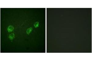Immunofluorescence analysis of HuvEc cells, using PLB (Phospho-Ser16+Thr17) Antibody. (Phospholamban antibody  (pSer16))