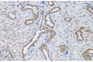 Immunohistochemistry of paraffin-embedded Rat kidney using ITGAV Polyclonal Antibody at dilution of 1:50 (40x lens). (CD51 antibody)