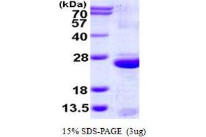 SDS-PAGE (SDS) image for Uroplakin 3A (UPK3A) (AA 19-207) protein (His tag) (ABIN666629)