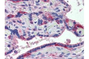 Human Placenta: Formalin-Fixed, Paraffin-Embedded (FFPE) (MARCH8 antibody  (C-Term))