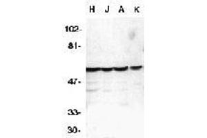 Western blot analysis of caspase-10 in HeLa (H), Jurkat (J), A431 (A), K562 (K) whole cell lysates with AP30189PU-N Caspase-10 antibody at 1 μg/ml. (Caspase 10 antibody  (C-Term))