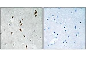 Immunohistochemistry analysis of paraffin-embedded human brain, using Mnk1 (Phospho-Thr385) Antibody. (MKNK1 antibody  (pThr385))