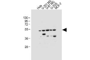 All lanes : Anti-DFNA5 Antibody (N-term) at 1:1000 dilution Lane 1: Hela whole cell lysate Lane 2: U-251 MG whole cell lysate Lane 3: U-87 MG whole cell lysate Lane 4: U-2OS whole cell lysate Lane 5: MCF-7 whole cell lysate Lysates/proteins at 20 μg per lane.