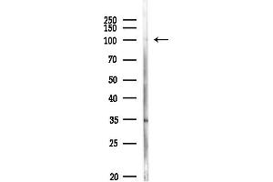 anti-RAD21 Homolog (RAD21) (C-Term) antibody