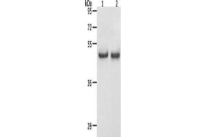 Gel: 12 % SDS-PAGE, Lysate: 40 μg, Lane 1-2: Hela cells, K562 cells, Primary antibody: ABIN7192614(SPAG4 Antibody) at dilution 1/1100, Secondary antibody: Goat anti rabbit IgG at 1/8000 dilution, Exposure time: 30 seconds (SPAG4 antibody)