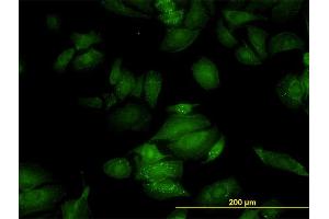 Immunofluorescence of monoclonal antibody to RGL2 on HeLa cell. (RGL2 antibody  (AA 644-743))