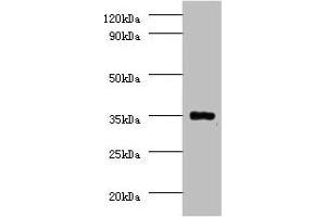 PPP2CB antibody  (Catalytic Subunit beta)