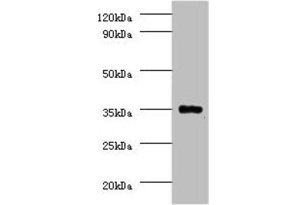PPP2CB Antikörper  (Catalytic Subunit beta)