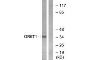 Western blot analysis of extracts from HeLa cells, using OR6T1 Antibody. (OR6T1 antibody  (AA 264-313))