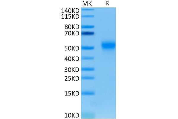 TIM3 Protein (AA 22-200) (His tag)