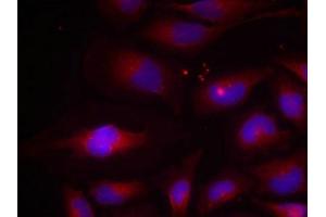 Immunofluorescence staining of methanol-fixed HeLa cells using NF-kappa,B p100(phospho-Ser870) antibody. (NFKB2 antibody  (pSer870))