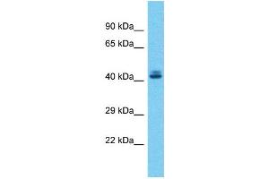 Host:  Rabbit  Target Name:  ZSCAN5A  Sample Type:  Liver tumor lysates  Antibody Dilution:  1. (ZSCAN5A antibody  (C-Term))