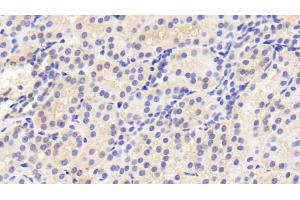 Immunohistochemistry (IHC) image for anti-Transferrin Receptor (p90, CD71) (TFRC) (AA 578-765) antibody (ABIN7437038)