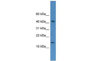 WB Suggested Anti-FLJ10490 Antibody Titration: 0. (FLJ10490 (Middle Region) antibody)