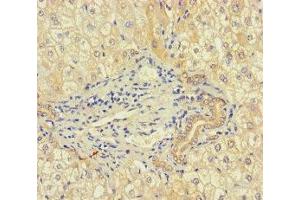 Immunohistochemistry of paraffin-embedded human liver tissue using ABIN7168083 at dilution of 1:100 (RIBC1 antibody  (AA 1-200))