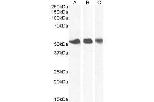 ABIN2613420 (1µg/ml) staining of Human Breast (A), Placenta (B) and Spleen (C) lysate. (SLC29A1 antibody  (N-Term))