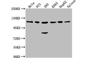 Western Blot Positive WB detected in: Hela whole cell lysate, PC3 whole cell lysate, 293 whole cell lysate, K562 whole cell lysate, HepG2 whole cell lysate, Rat spleen tissue All lanes: CDKL5 antibody at 1:2000 Secondary Goat polyclonal to rabbit IgG at 1/50000 dilution Predicted band size: 116, 108 kDa Observed band size: 116 kDa (CDKL5 antibody  (AA 790-921))