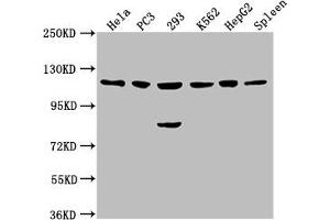 Western Blot Positive WB detected in: Hela whole cell lysate, PC3 whole cell lysate, 293 whole cell lysate, K562 whole cell lysate, HepG2 whole cell lysate, Rat spleen tissue All lanes: CDKL5 antibody at 1:2000 Secondary Goat polyclonal to rabbit IgG at 1/50000 dilution Predicted band size: 116, 108 kDa Observed band size: 116 kDa (CDKL5 antibody  (AA 790-921))