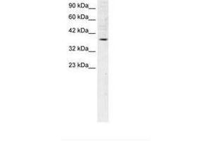 Image no. 1 for anti-FBJ Murine Osteosarcoma Viral Oncogene Homolog B (FOSB) (AA 240-289) antibody (ABIN202278) (FOSB antibody  (AA 240-289))