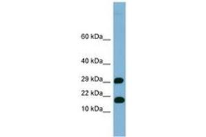 TRAPPC2L antibody  (N-Term)