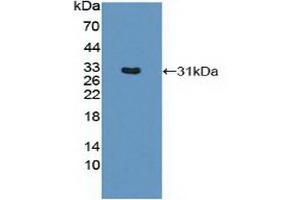 Detection of Recombinant MHCDRb1, Mouse using Polyclonal Antibody to HLA Class II Histocompatibility Antigen, DRB1 Beta Chain (HLA-DRB1) (HLA-DRB1 antibody  (AA 27-264))