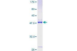 Image no. 1 for RAS-Like, Family 10, Member B (Rasl10b) (AA 1-203) protein (GST tag) (ABIN1317513) (Rasl10b Protein (AA 1-203) (GST tag))