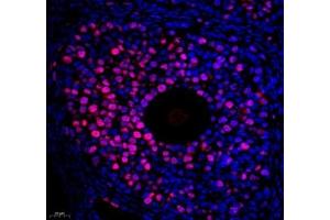 Immunofluorescence of paraffin embedded mouse ovary using Top2 (ABIN7075937) at dilution of 1:500 (400x lens) (Topoisomerase II alpha antibody)