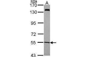 WB Image Sample (30 ug of whole cell lysate) A: H1299 7. (UGP2 antibody)