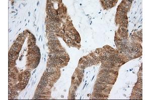 Immunohistochemical staining of paraffin-embedded Human liver tissue using anti-ACAT2 mouse monoclonal antibody. (ACAT2 antibody)